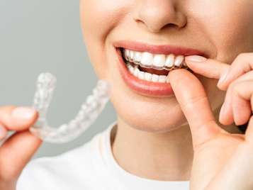 A straighter smile