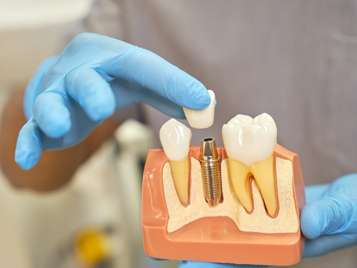 Prosthodontic care