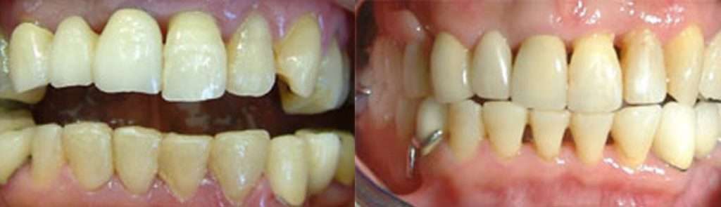 Case 1 before and after