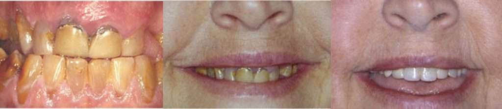 Case 2 before and after