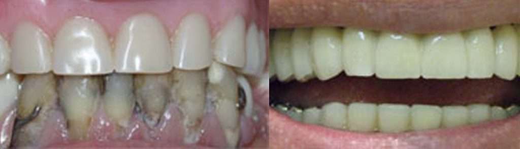 Case 3 before and after