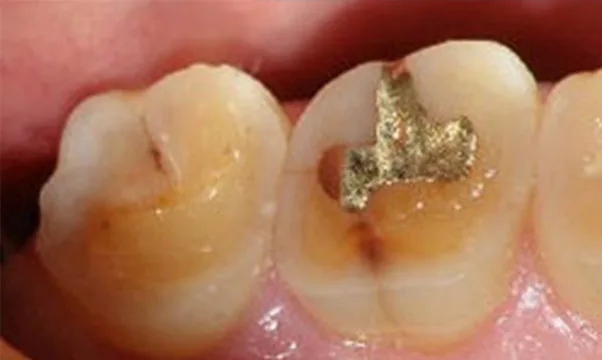 Case 1 before