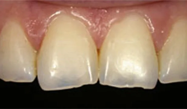 Case 4
