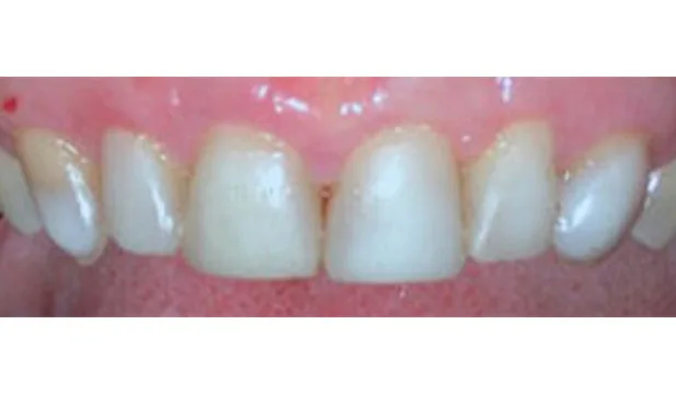 Case 5