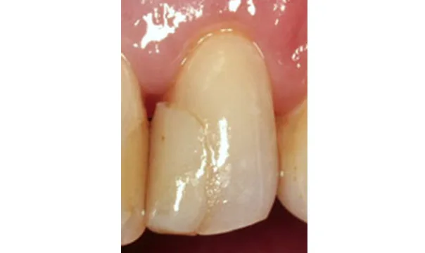 Case 6