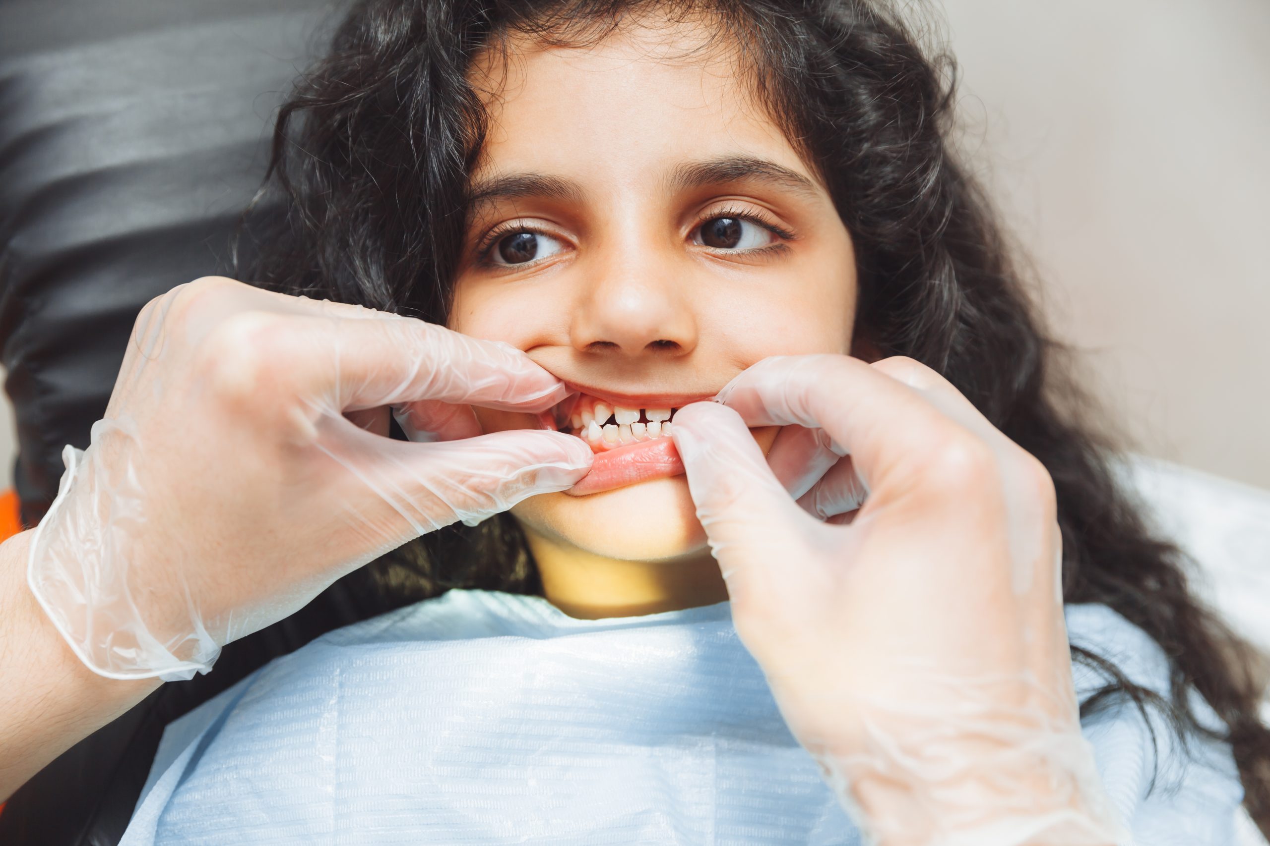Teeth Moved After Braces? Relapse Treatment in Turramurra
