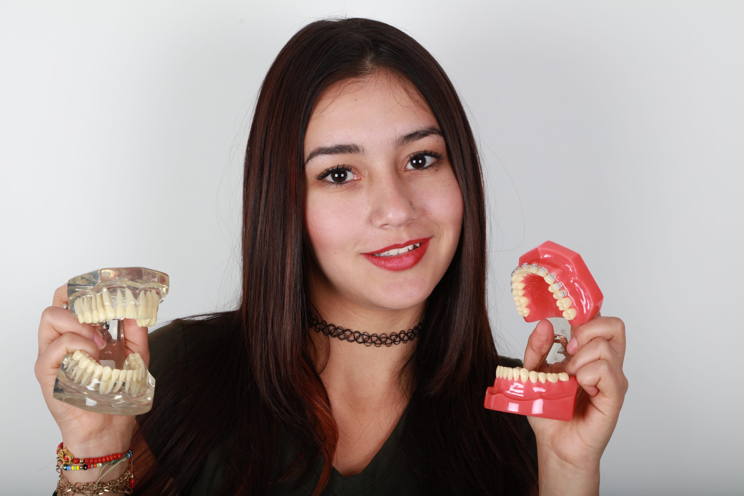 Loose Dentures Fix in Turramurra